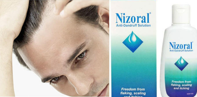 El shampoo Nizoral sirve para caída del cabello
