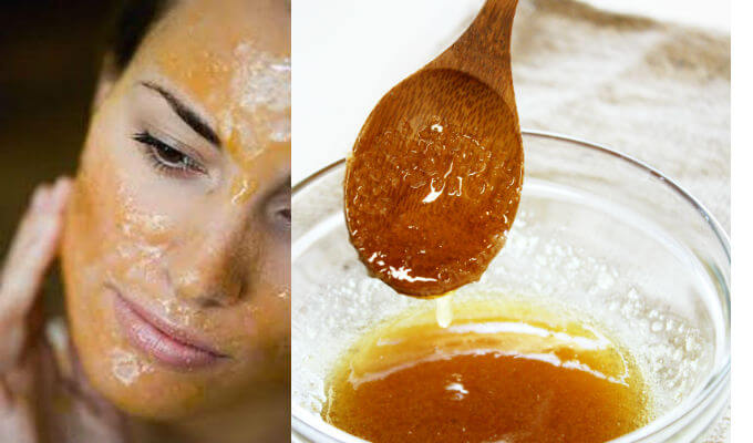 Miel para combatir el acné facial